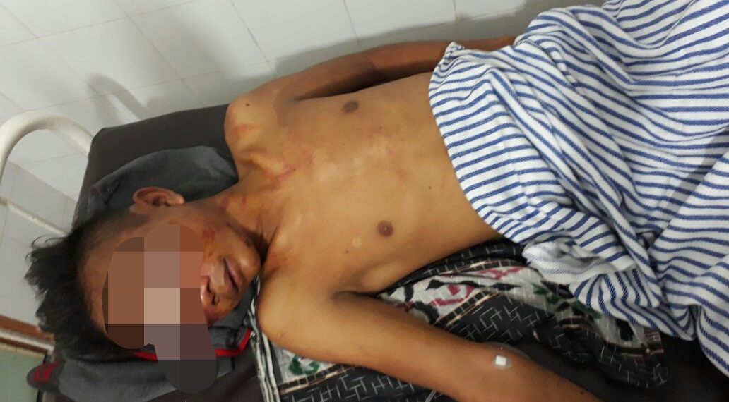 Pelaku Pencurian Ketangkap Warga di Kubang Jaya Siak Hulu, Kapolsek Himbau Warga Tidak Main Hakim Sendiri