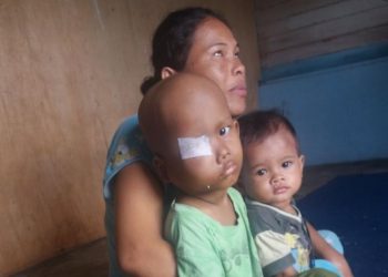 David Marsen Bocah 4 Tahun Idap Kanker