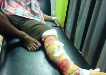 Buaya Liar Serang Warga Danau Lancang Saat Menyeberangi Sungai Siak Pacah