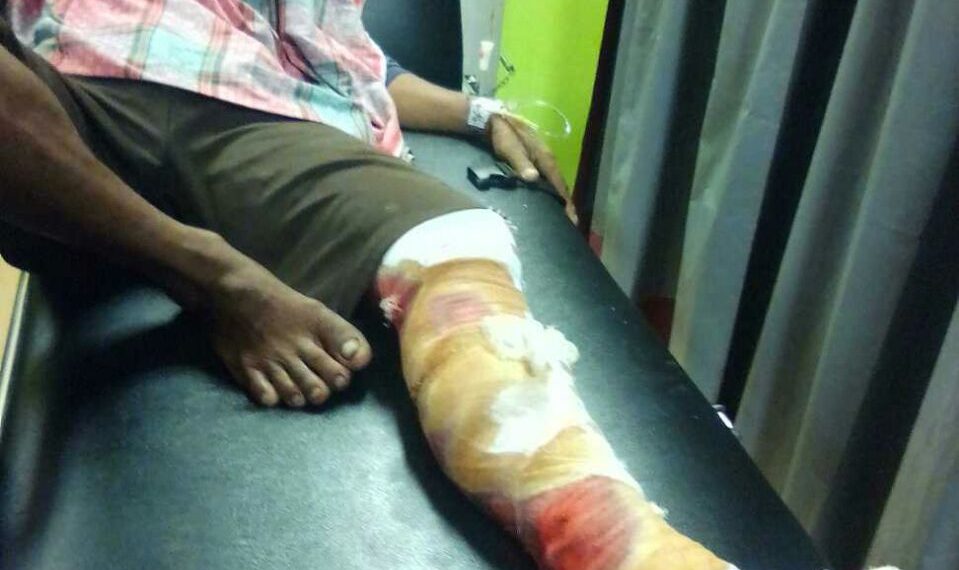 Buaya Liar Serang Warga Danau Lancang Saat Menyeberangi Sungai Siak Pacah