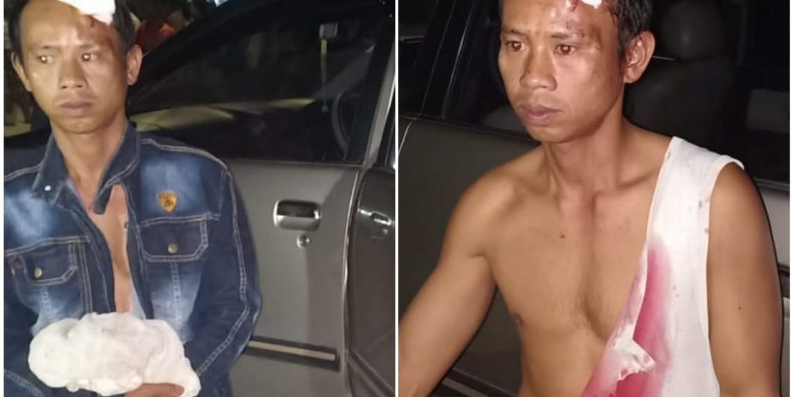 Telah terjadi Penganiayaan Salah seorang Warga Perumahan Griya Taman Melati Kec.Tapung Oleh Orang Tidak Di Kenal