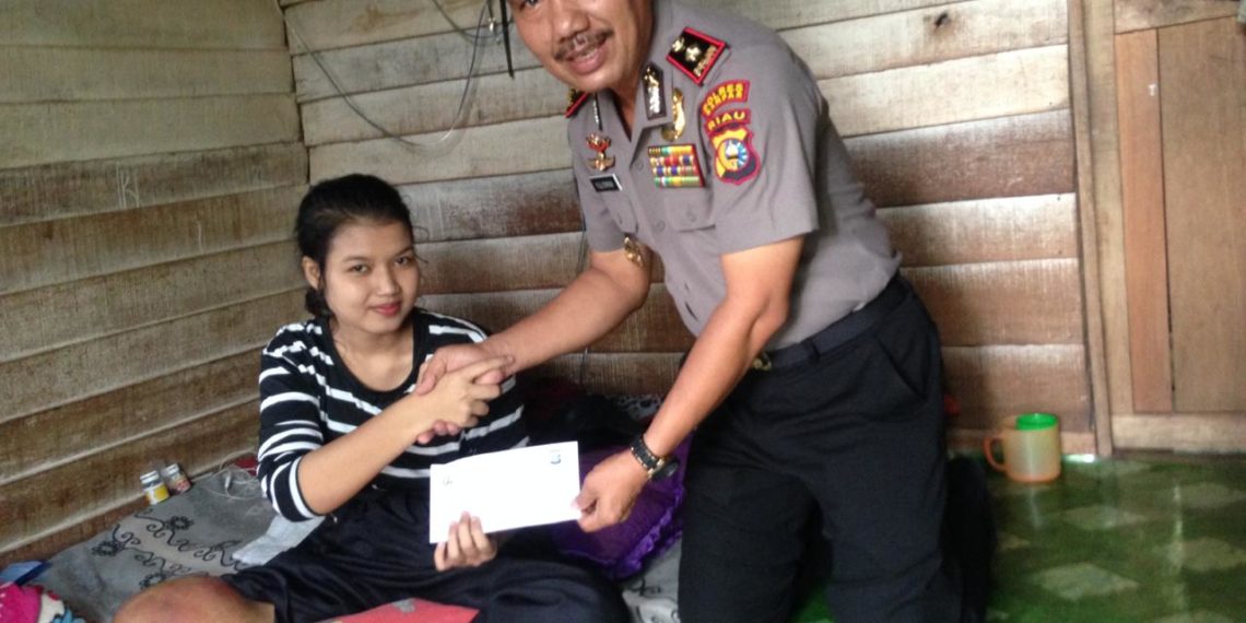 Kapolres Kampar Perintahkan Kapolsek Kampar Kiri Mewakilinya Temui Riska Gadis Penderita Tumor