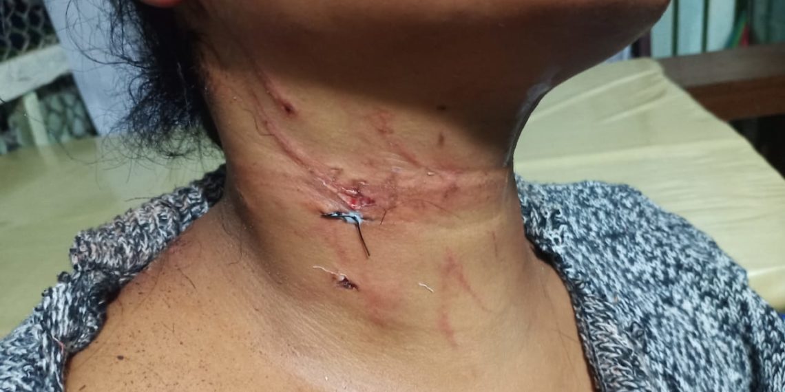 Tolak Layani Nafsu Bejad Sopir Truk, Wanita ini Dianiaya Hingga Alami Luka Berat
