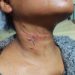 Tolak Layani Nafsu Bejad Sopir Truk, Wanita ini Dianiaya Hingga Alami Luka Berat